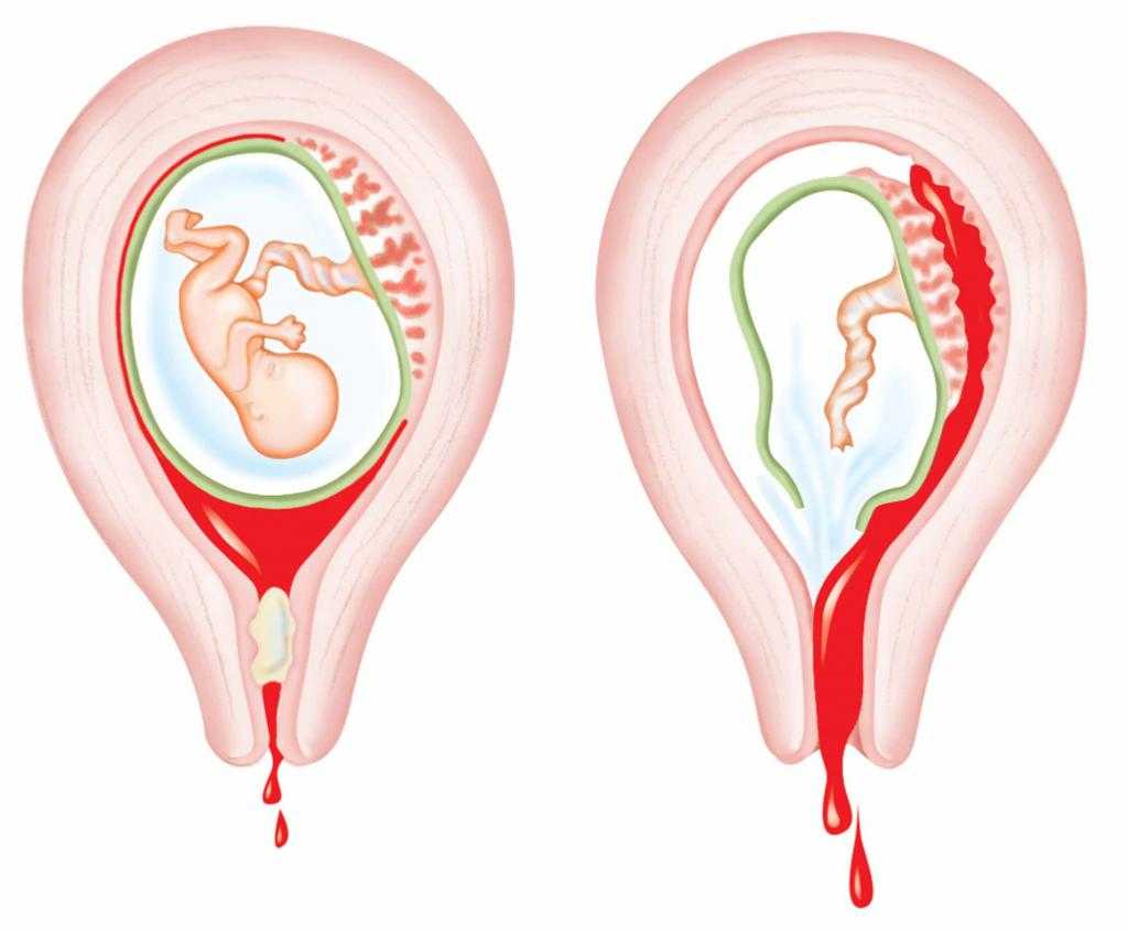 Короткий менструальный цикл. в чем причина?